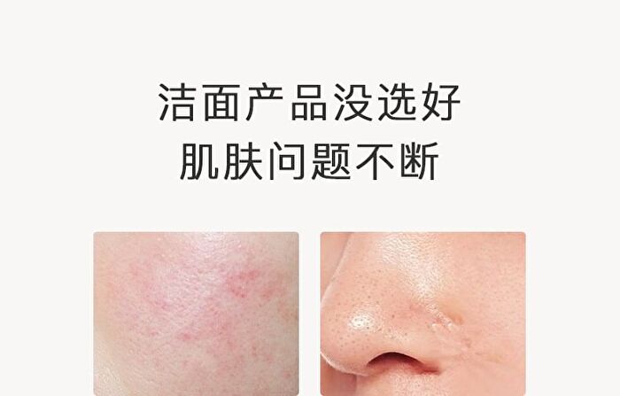 Gentle Soothes Cleanser Dew - Standard - 120ml