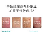 6D Hyaluronic Acid Moisturizing Soothing Water - 1pc - 100ml