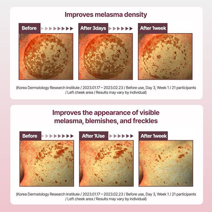 Madeca Mela Capture Ampoule Pad - 60 pads