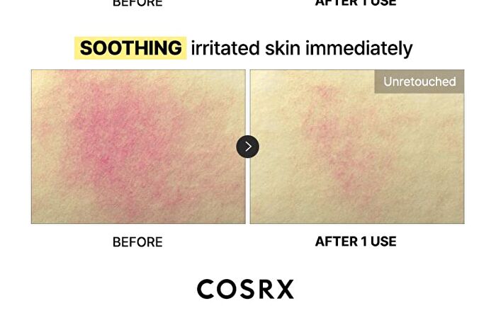 Cosrx Advanced Snail Mucin Glass Glow Hydrogel Mask Set - 34g x 3 sheets