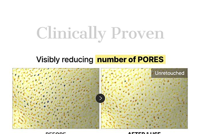 Cosrx Advanced Snail Mucin Glass Glow Hydrogel Mask Set - 34g x 3 sheets