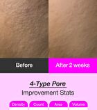 Odeloi Black Cherry Pore Tightening Cream Luftig - 2025 Version - 100ml