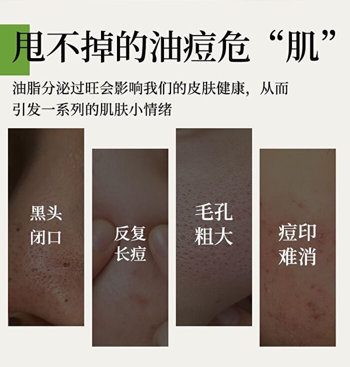 Tea Tree Anti-Acne Mask Set - Set (5pcs)