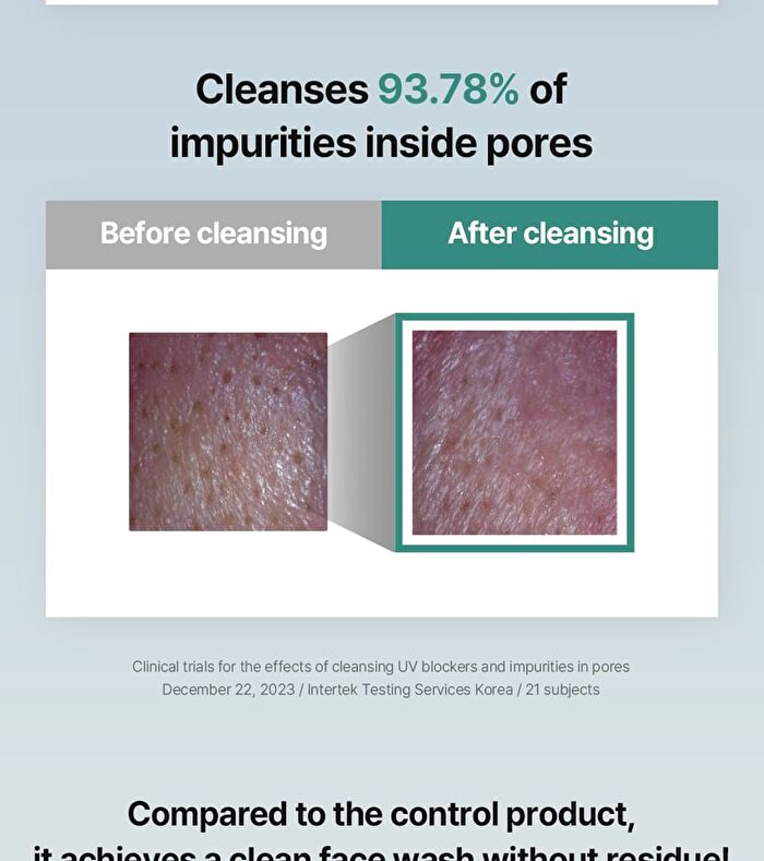 Mild Cleansing Foam - 150ml