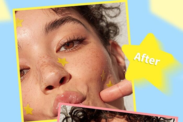 Smile Star Pimple Patches - 1-3 - Yellow - 1pcs