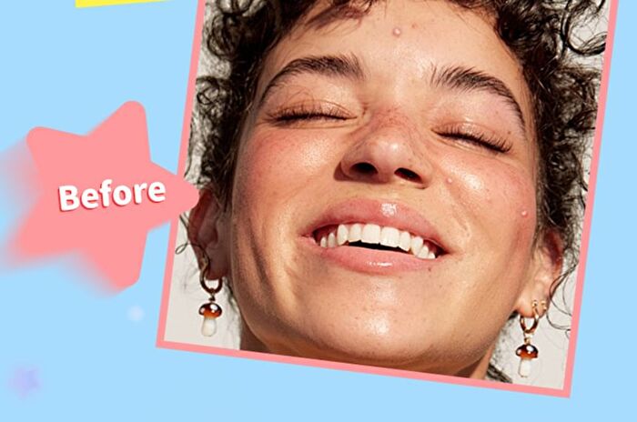 Smile Star Pimple Patches - 1-3 - Yellow - 1pcs