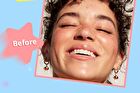 Smile Star Pimple Patches - 1-3 - Yellow - 1pcs