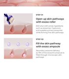 id EXO-V® ProLifting Set - 3pcs