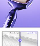 id EXO-V® ProLifting Set - 3pcs
