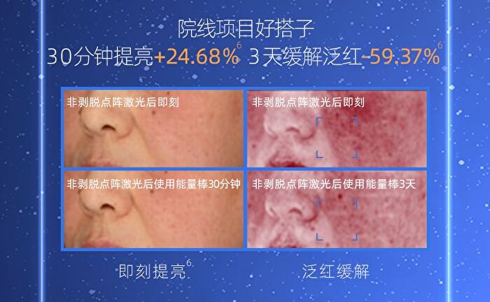 DNA Sodium (PDRN) Shaping Repairing Essence - Set (1.5ml x 30pcs)