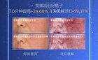 DNA Sodium (PDRN) Shaping Repairing Essence - Set (1.5ml x 30pcs)