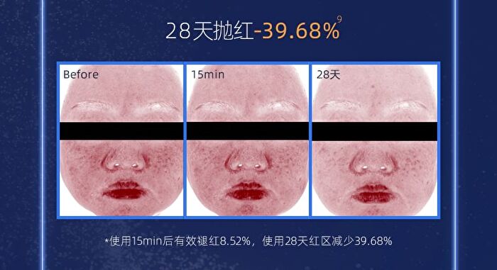 DNA Sodium (PDRN) Shaping Repairing Essence - Set (1.5ml x 30pcs)