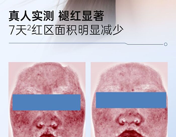 Skin Barrier Repairing Essence - 100g