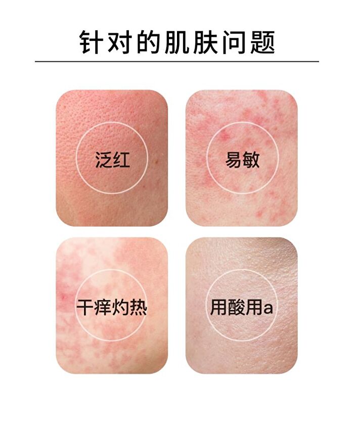 Olive Oil Serum (For Sensitive Skin) - 30ml