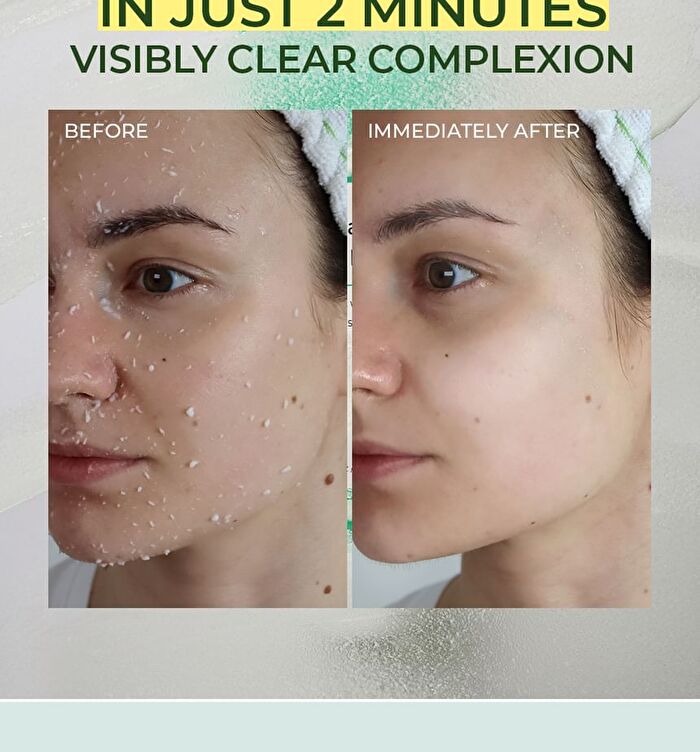 Mother Made Exfoliating Aqua Peel Gel - 2025 Version - 100ml 