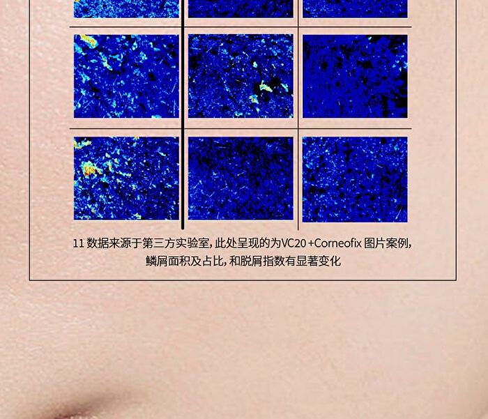 Purifying Anti-Acne Cleansing Mud Mask - 50g