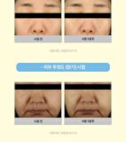 Bring Green Fresh Mask  - 4 Types - Aloe Soothing