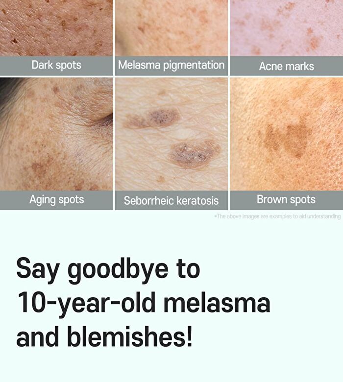 Anti-Melasma Cica Intensive Serum - 30ml