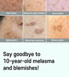 Anti-Melasma Cica Intensive Serum - 30ml