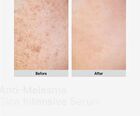 Anti-Melasma Cica Intensive Serum - 30ml