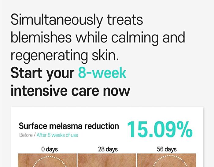 Anti-Melasma Cica Intensive Serum - 30ml