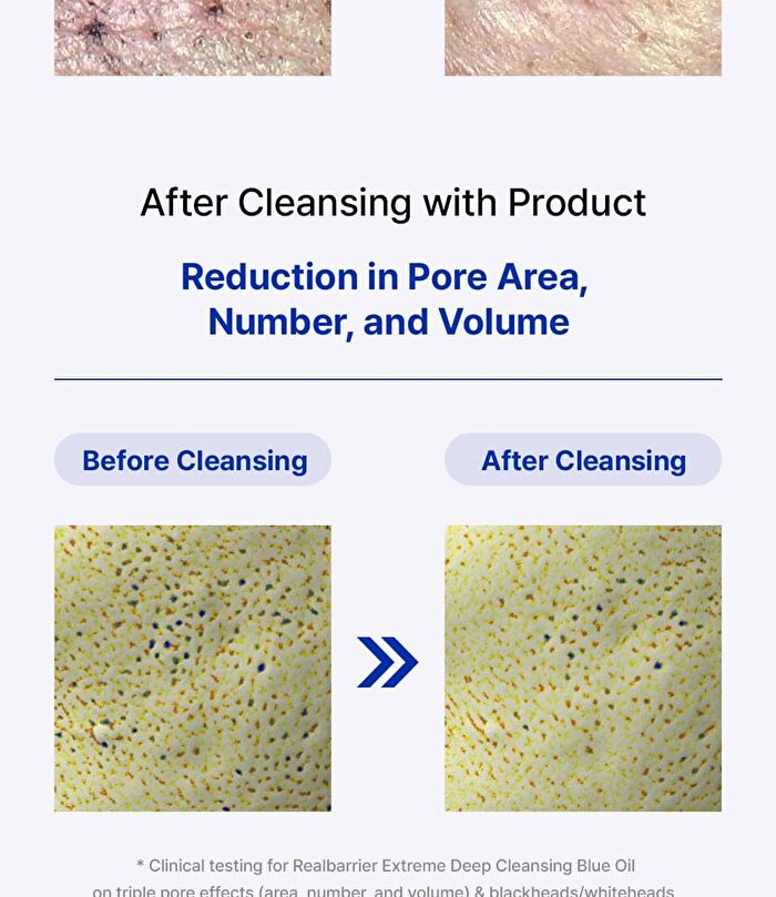 Extreme Deep Cleasing Blue Oil - 200ml
