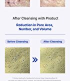Extreme Deep Cleasing Blue Oil - 200ml