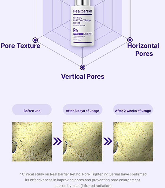 Retiniol Pore Tightening Serum - 30ml