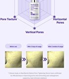 Retiniol Pore Tightening Serum - 30ml