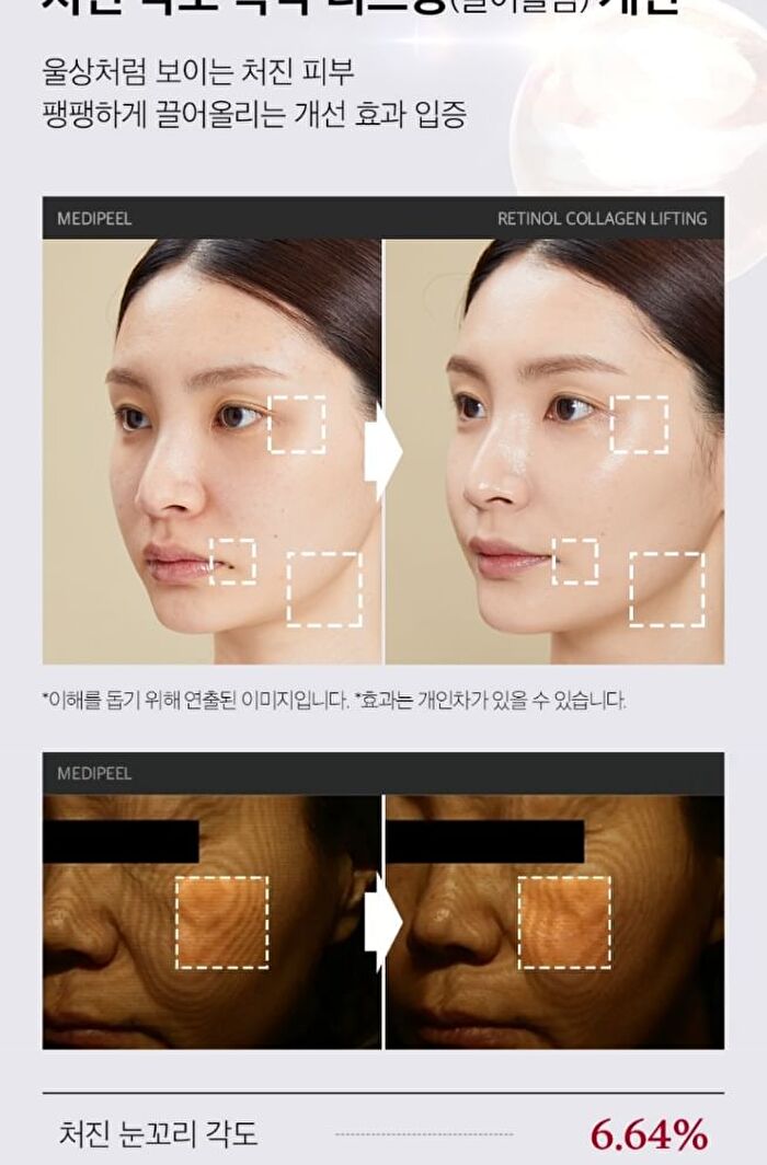 Retinol Collagen Lifting Toner - 150ml