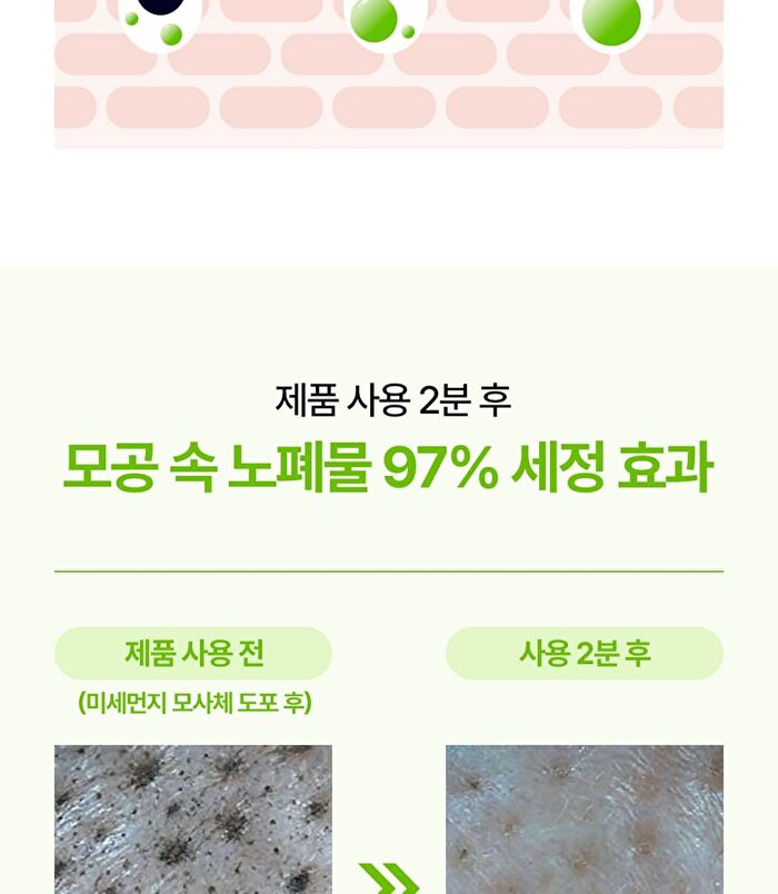 Control-T Acid Pore Clay Pack - 80ml