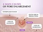 Purple PDRN Pore Minimizing Serum - 30ml