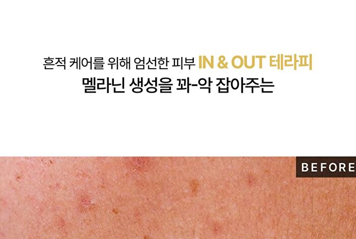Heveblue Single Vita Dark Spot Pine-Ampoule - 50ml