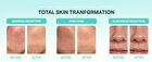 Bring Green Tea Tree Cica Trial Kit - 3 pcs