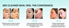 Bring Green Tea Tree Cica Trial Kit - 3 pcs