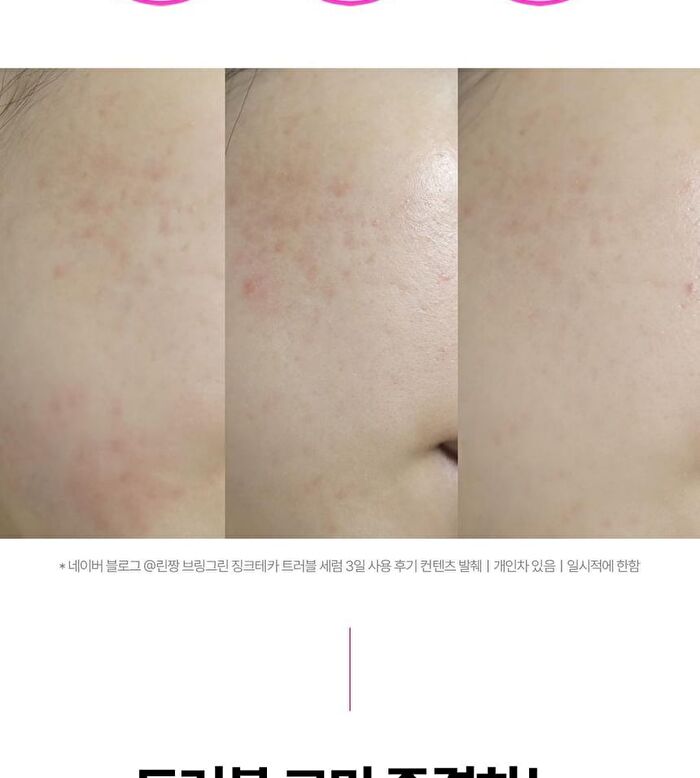 Bring Green Tea Tree Cica Set - 3 pcs