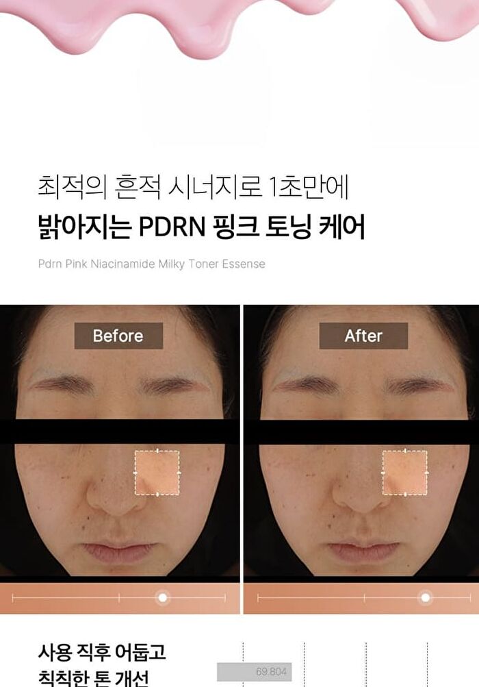 PDRN Pink Niacinamide Milky Toner - 150ml