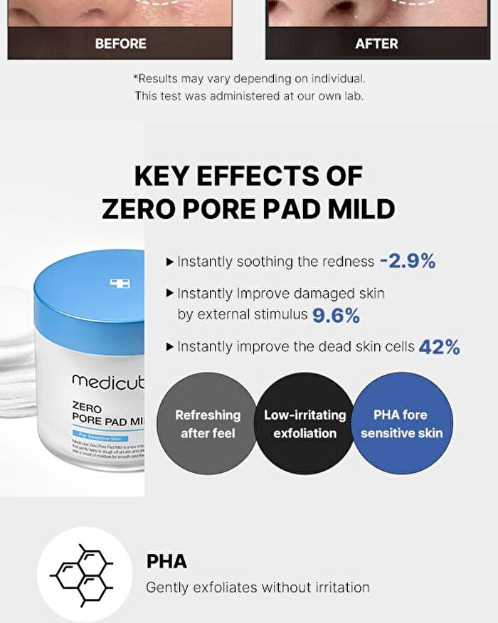 Zero Pore Pad Mild (EU/UK Packaging) - 70 pads