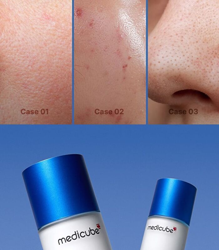 Zero Pore Serum 2.0 (EU/UK Packaging) - 37ml
