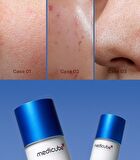 Zero Pore Serum 2.0 (EU/UK Packaging) - 37ml
