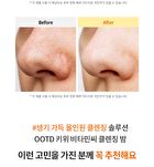 Ootd Kiwi Vitamin C Cleansing Balm - 100ml