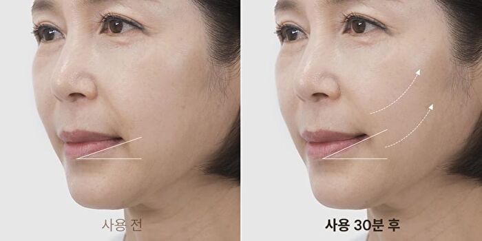Line Lifting Hydrogel Smile Line Patch - 6 patches