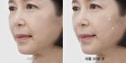 Line Lifting Hydrogel Smile Line Patch - 6 patches