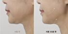 Marshique Line Lifting Hydrogel Jawline Patch - 3 patches