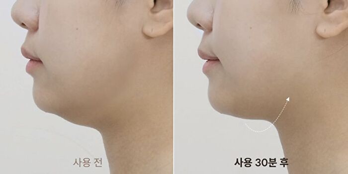 Marshique Line Lifting Hydrogel Jawline Patch - 3 patches