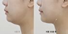 Marshique Line Lifting Hydrogel Jawline Patch - 3 patches