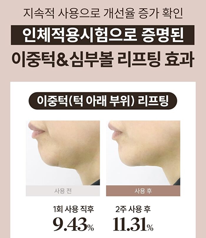 Marshique Line Lifting Hydrogel Jawline Patch - 3 patches