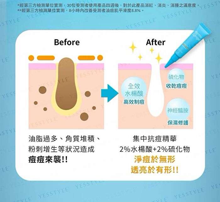 Acne Care Intensive Gel - 10ml