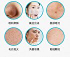 Acne Care BHA Pore Clear Pad - 65 pcs