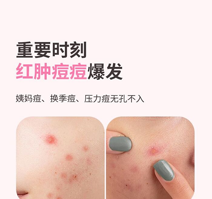 Yaozhi Pure Radiance Acne Pimple Patch - 3 Types - Twilight Pink (36pcs)